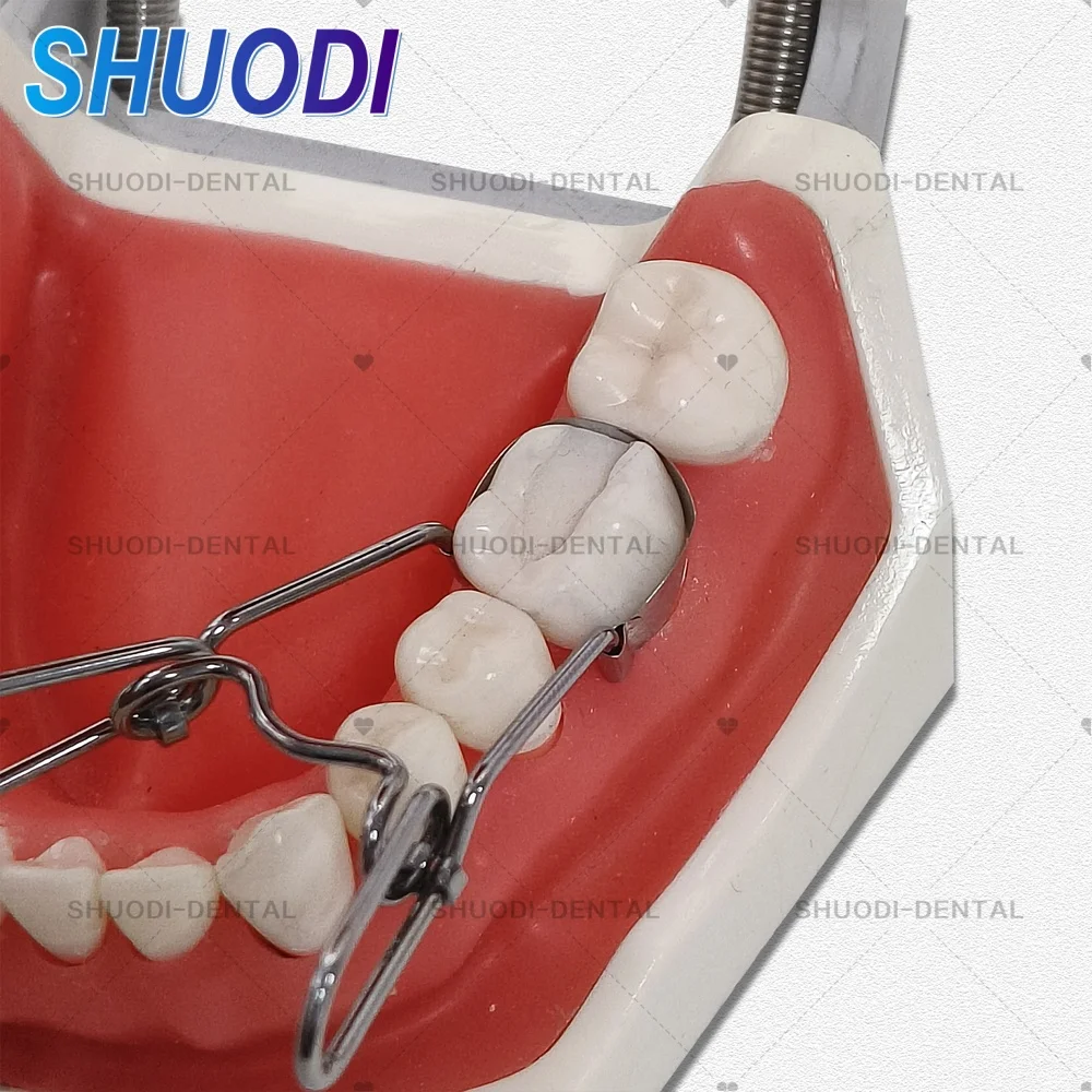 عالية الجودة الأسنان السرج احيط المصفوفات المعدنية مجموعة مصفوفة مجموعة عالمية مع مشبك الربيع مصفوفات مقطعية للأسنان