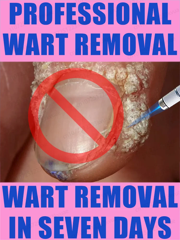 Dios de eliminación de verrugas, ver resultados en siete días.