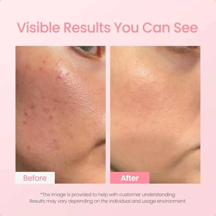 네오젠랩 더말로지 에클리어 수딩 아크네 케어 핑크 이레이저 스팟 케어