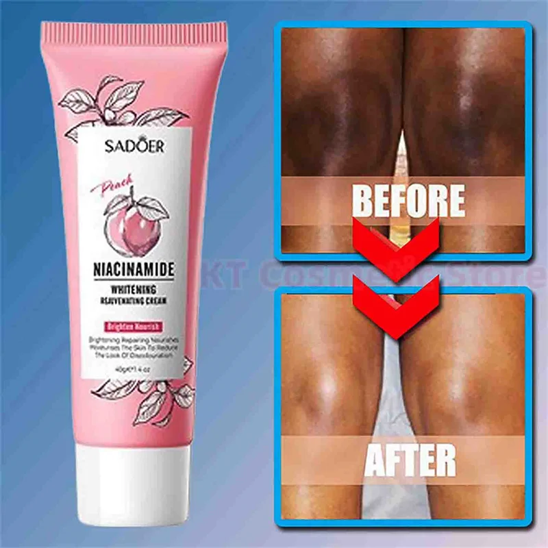 

Niacinamide Whitening Rejuvenating Cream Knee Fade Pigmentation Inner Thigh Private Parts Underarm Joint Bleaching Brighten Gel