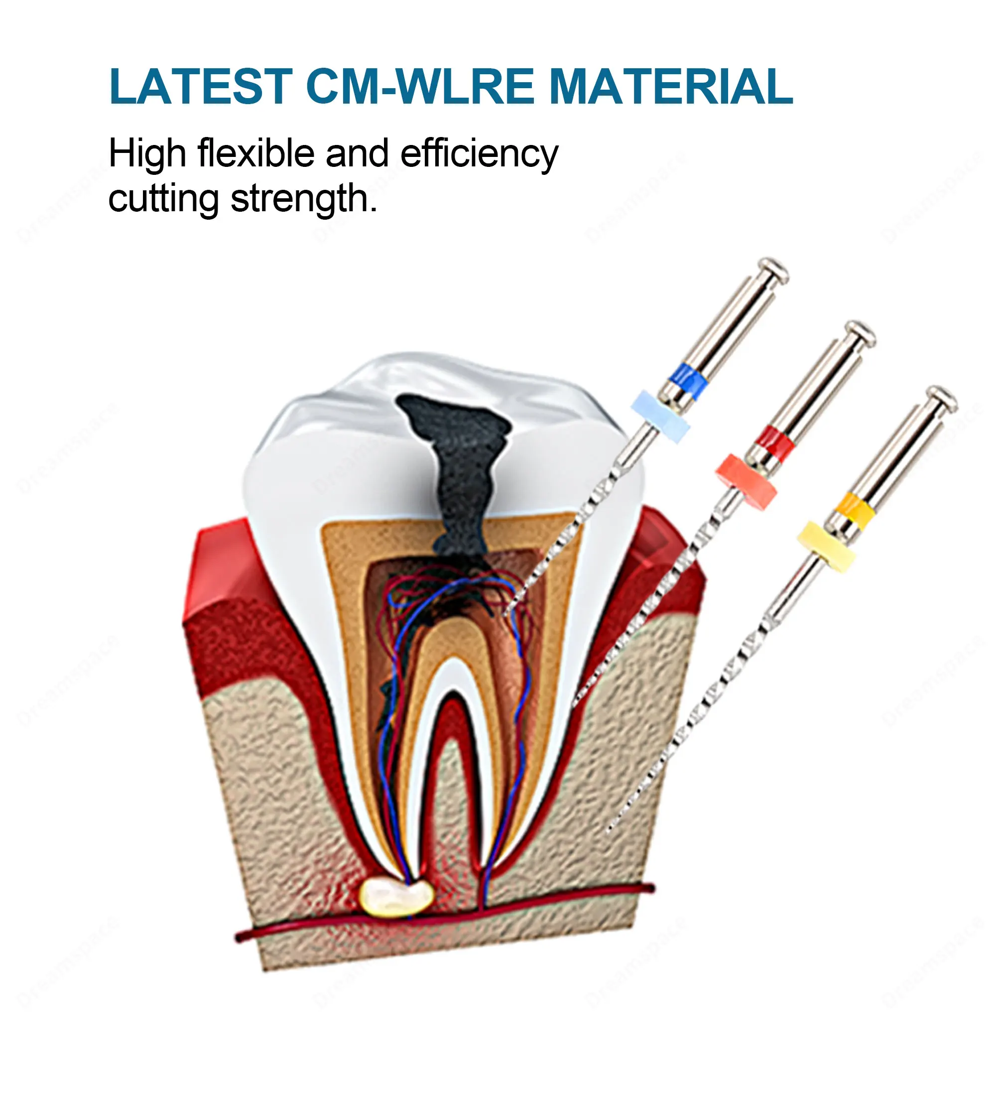 limas-endodonticas-de-niti-para-retratamento-de-canal-radicular-instrumento-odontologico-para-limpeza