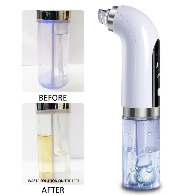Pore Cleaner Extractor Bestverkopende Black Head Remover Vacuüm mee-eter verwijderaar met watertank