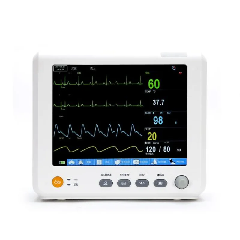 Veterinary Multiparameter Patient Monitor for Animal Hospitals & Clinics Touchscreen & Easy Operation Dog/Cat/Horse Use