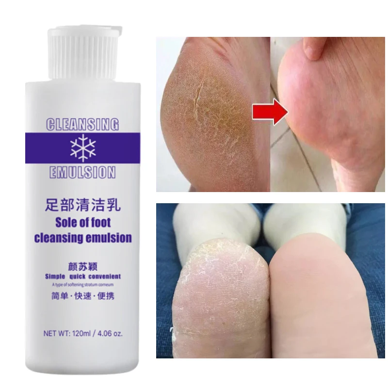 

120ml Foot Exfoliator Foot Cuticle Remove Dead Softener Remove Dead Skin Calluses Foot Mask Anti-Cracked Pedicure Nail Enhancer