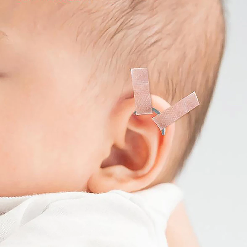 Baby Ear Corrector Cuttable Breathable Infant Toddler Auricle Valgus Silicone Correction Patch With Ear Support Patches