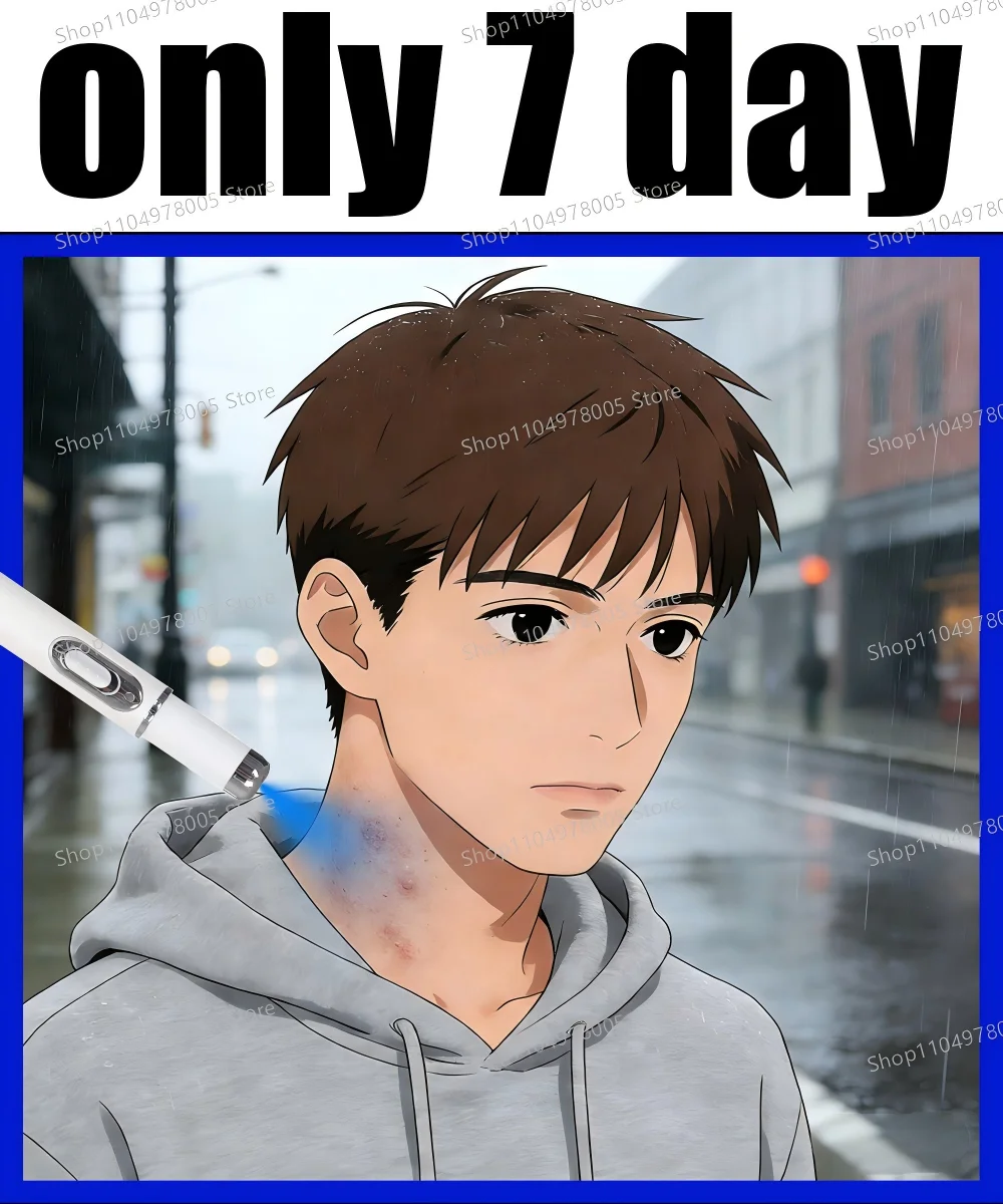 

Ручка для удаления бородавок с синим светом, решает ваши проблемы в течение 7 дней, горячие продажи инструментов для ухода за бородавками