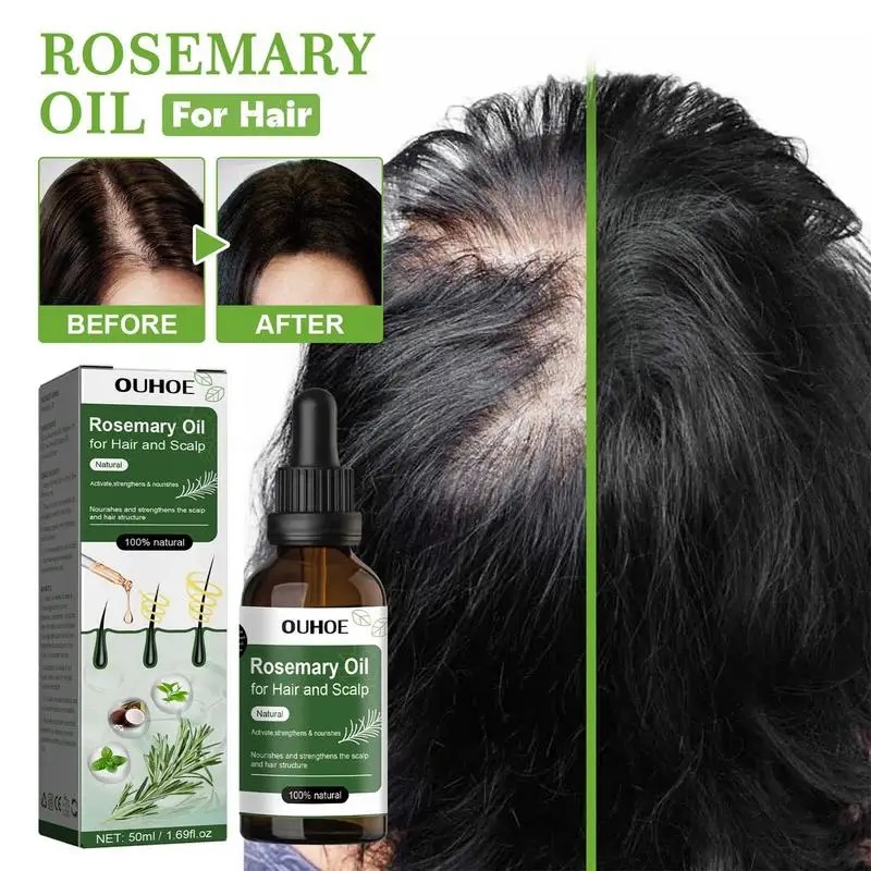 

Rosemary Hair Oil Hair Growth Products Organic Hair Scalp Hair Strengthening Oil For Nourish Shiny Hair Cleansing Oil For hair