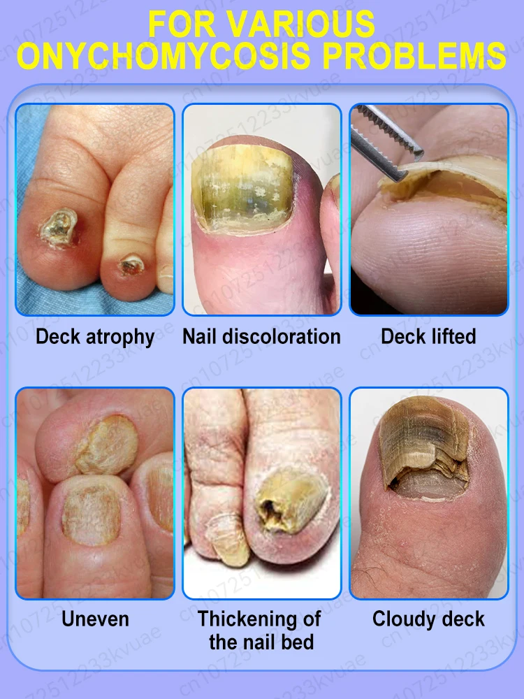 痕跡を残さず穏やかな浸透、より安心