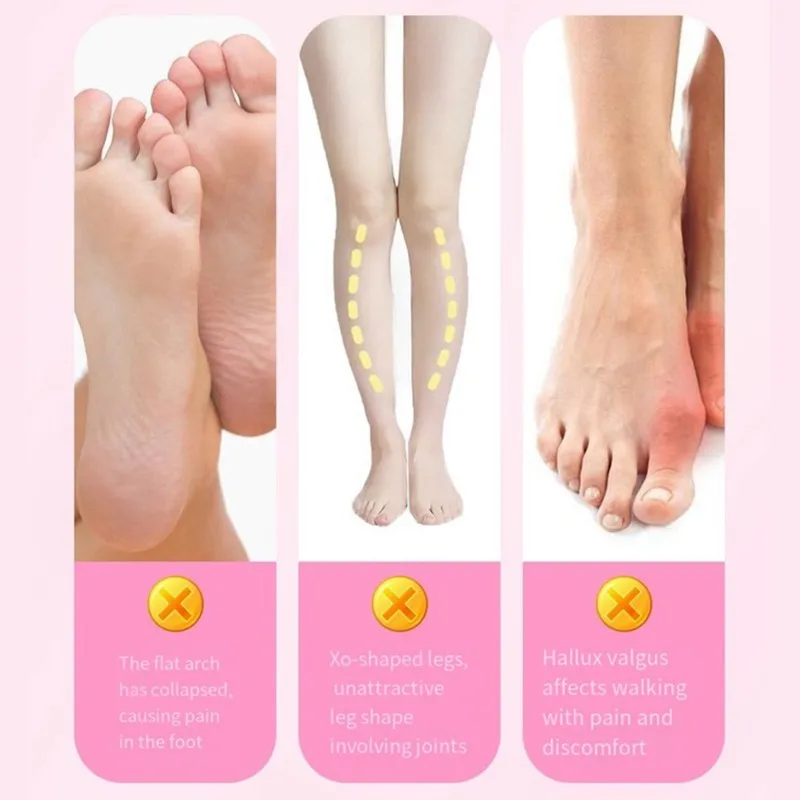

A83G-Separator Arch Trainer For Bunions-For Women Toe Corrector-Japanese Design, Leg Alignment Support