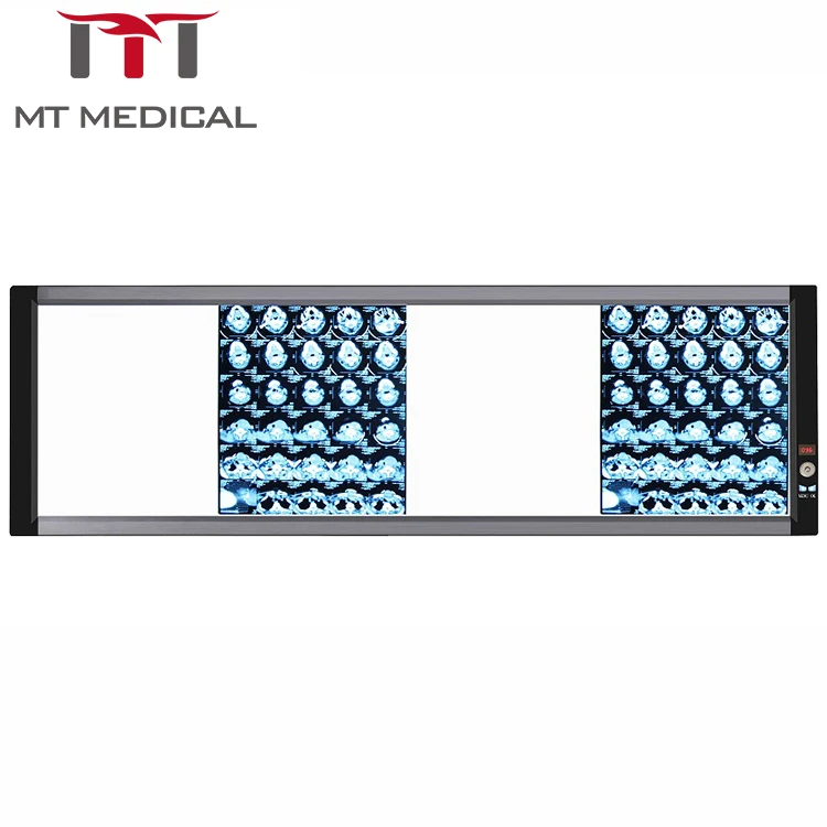 MT Medical Ultra Thin View  Led X Ray Film Medical Union Hospital Scanner Box Negatoscope Four Panel X-Ray Film Viewer