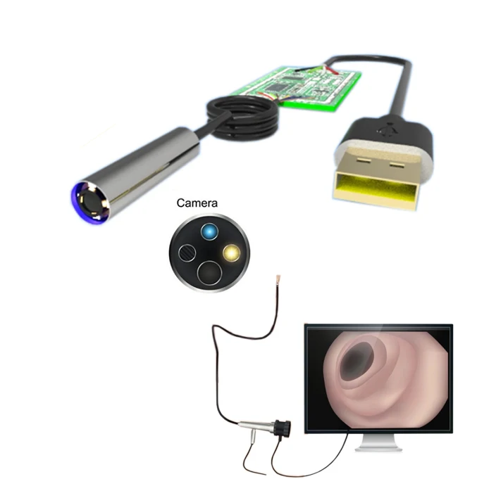 

OVM9734 Mini Endoscope Module for Naspharygyoscope Laryngyoscope