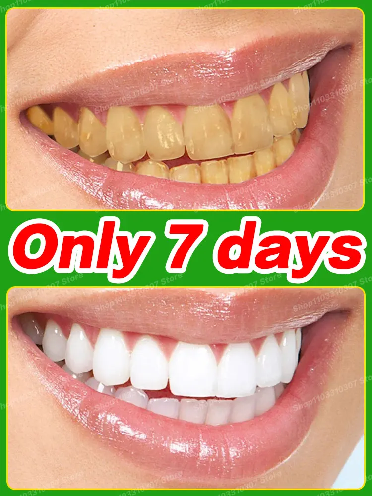 

Teeth whitening Tooth Cleaning Tartar Improve Oral care