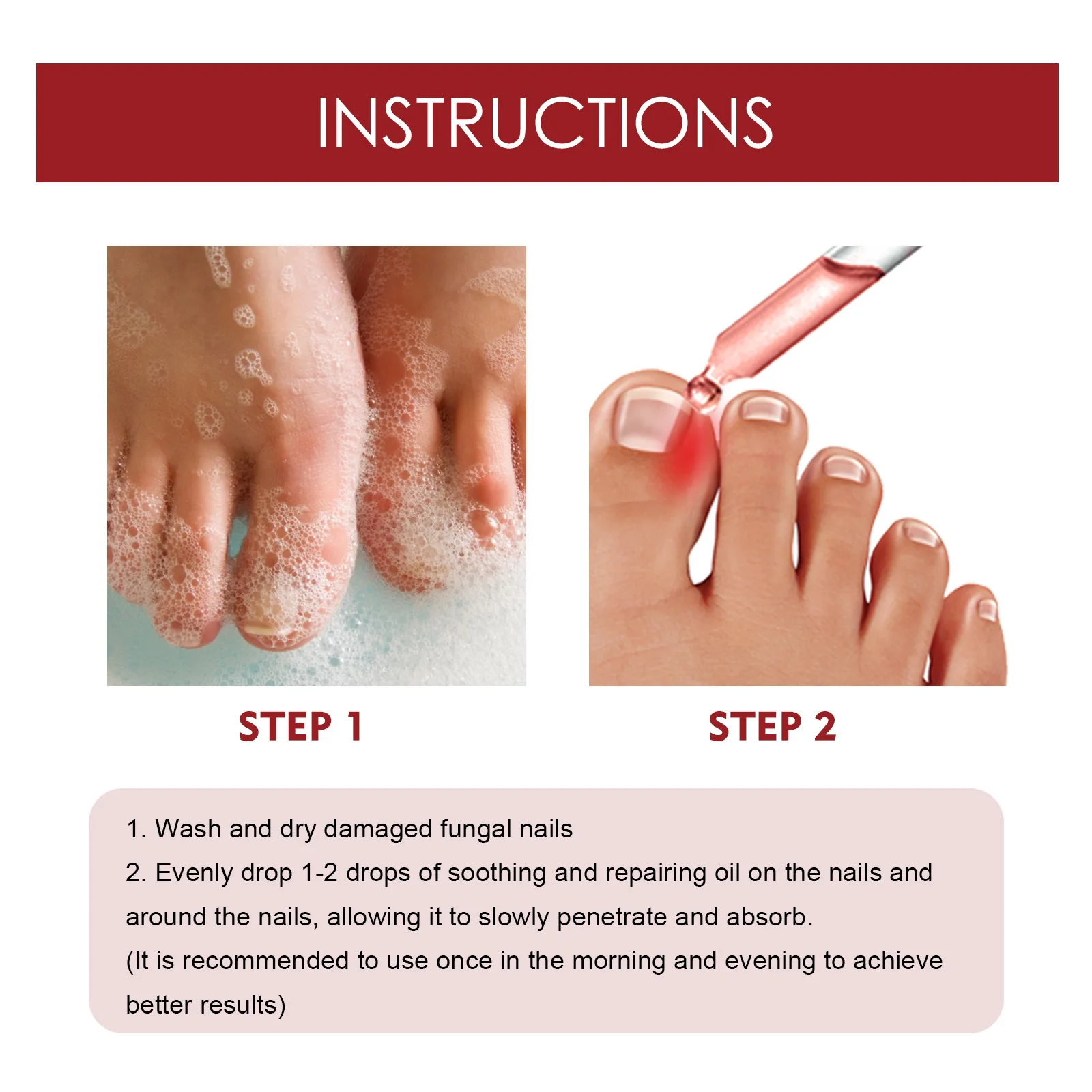 발톱무좀 10ML Ingrown Toenail Drops Ingrown Toenail Relief Oil Portable Ingrown Toenail Removal Drops Essential Oil Solution uñas