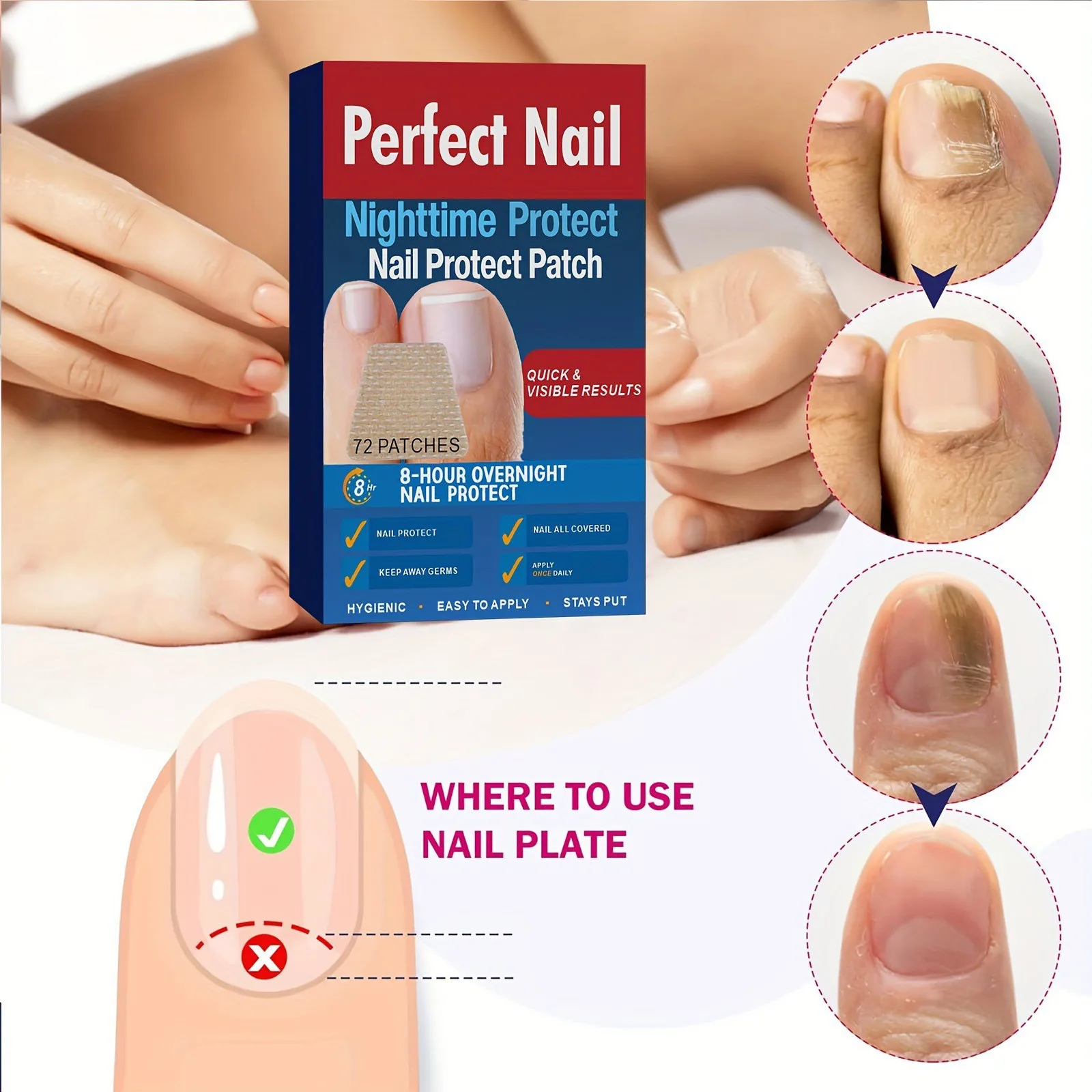 Nail Care Patches Improve Yellow And Thickened Nails Toenail Corrector Waterproof Repair Patch For Discolored Or Damaged Nails