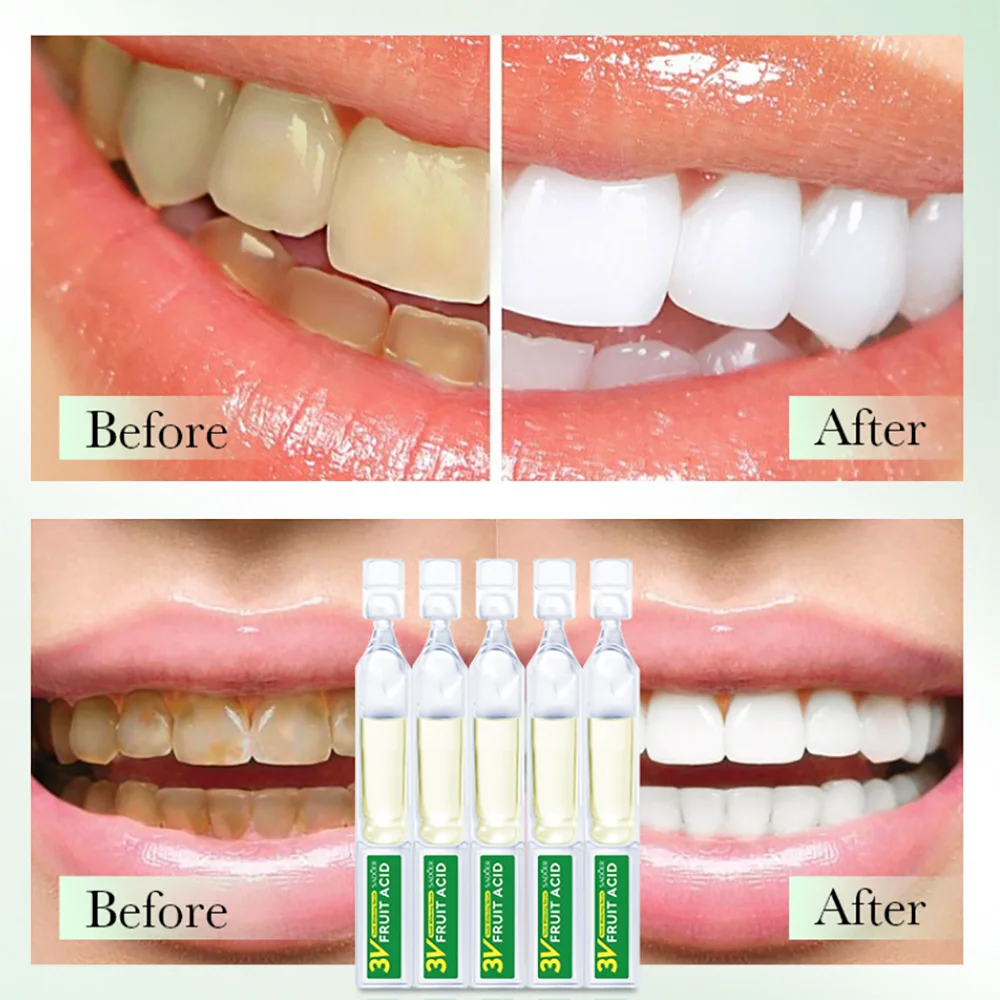 Serum z kwasem owocowym Blanquear Dientes Blanchiment dentyres Efficace Clareador De Dentes Diş Beyazlatma Aleti Blanchiment