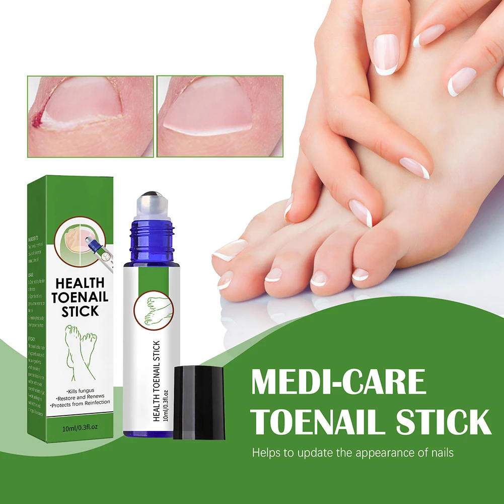 10ML สุขภาพ Toenail Stick Mild หนาเล็บรักษา Liquid Nail Care อุปกรณ์