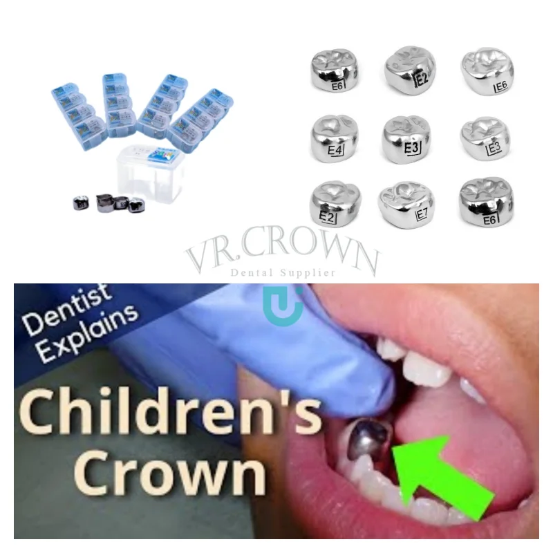 Kids Molar Metal Crowns | Temporary Crown Veneers Material Anterior Front Back Molar Teeth | Stainless Steel Kids Crown Molar