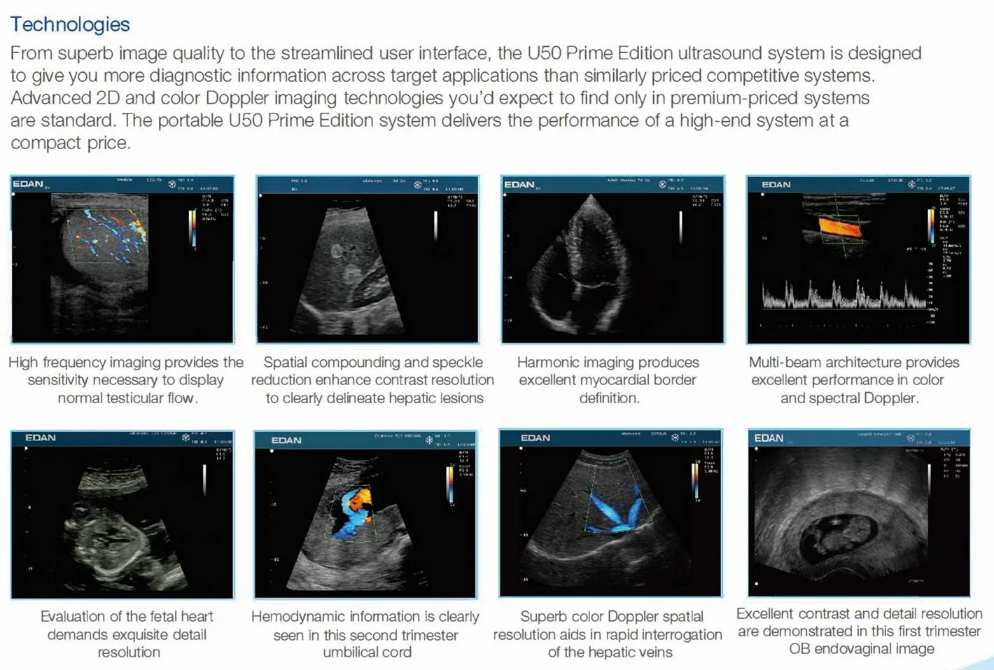 EDAN U50 Scanner Machine ecografo ultrasonido Laptop Color Doppler portable ultrasound price