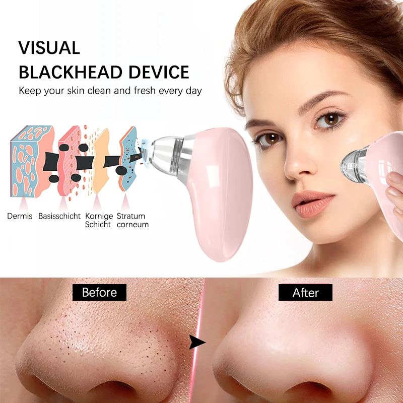 Facial  Vacuum Black Head Remover with Camera Pore Deep Cleaning Pimple Remover Tool Blackhead Removal Acne Point Noir Extractor