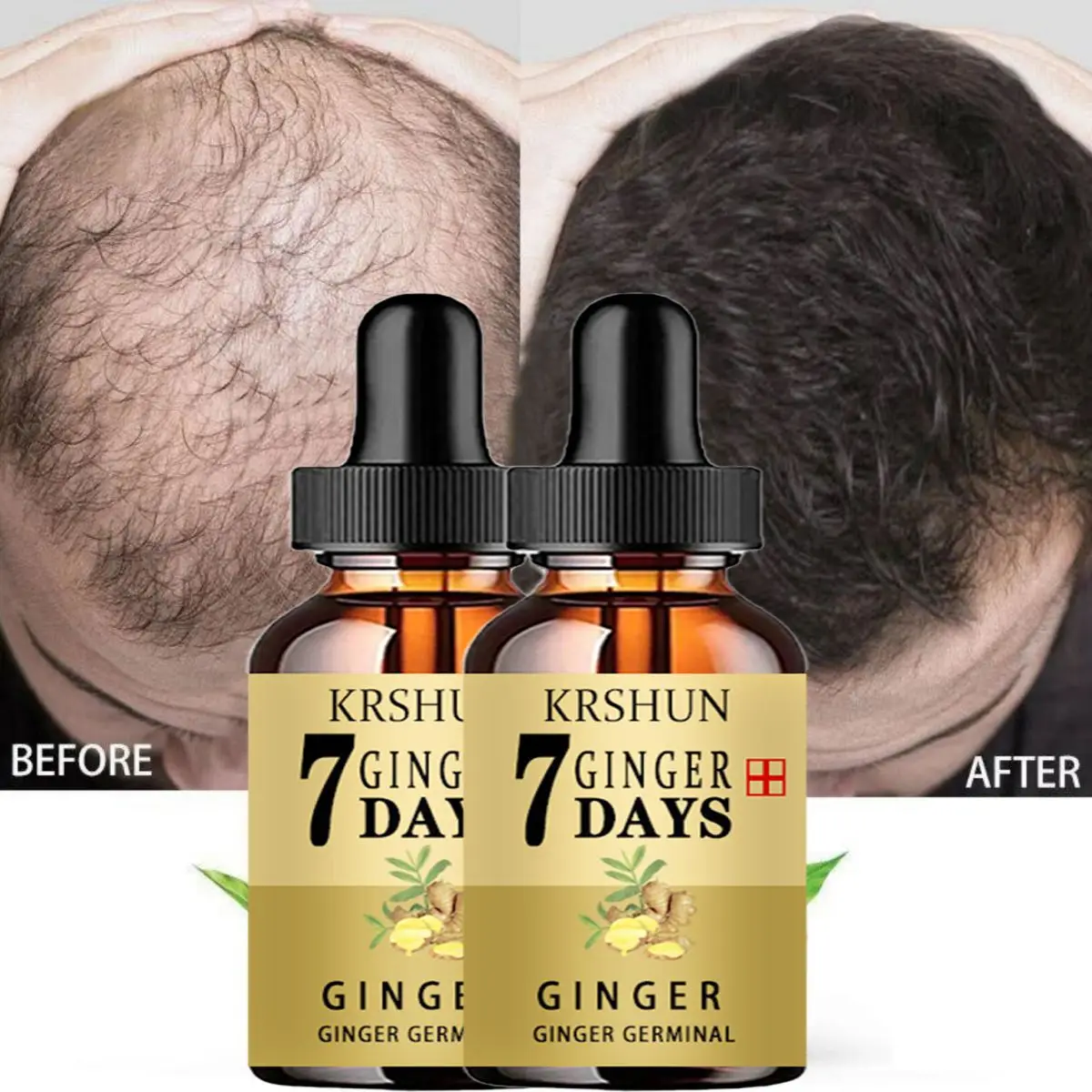 

Hair Growth Serum Anti Preventing Hair Loss Alopecia Liquid Damaged Hair Repair Growing Faster