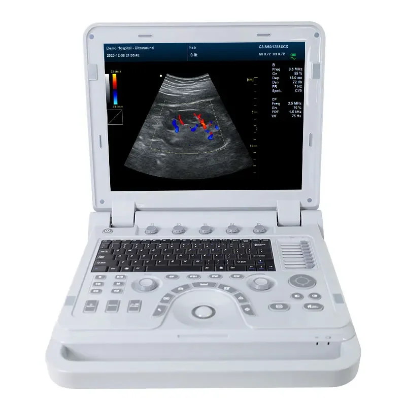 CONTEC CMS1700A  medical Color Doppler cardiac ultrasound equipment