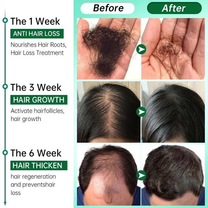 7 Days Fast Grow Hair Growth S - Hair Care Fragrance Essential Oil ulasan dan harga