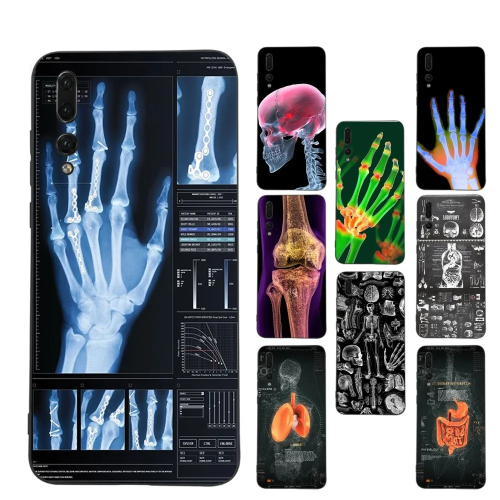 Radiological human organs Skeleton Phone Case For Huawei P 8 9 10 20 30 40 50 Pro Lite Psmart Honor 10 lite 70 Mate 20lite