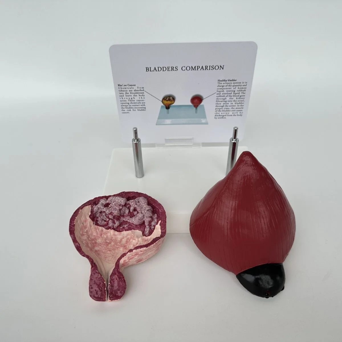 Comparative model of human healthy bladder and smoking bladder, pathological bladder