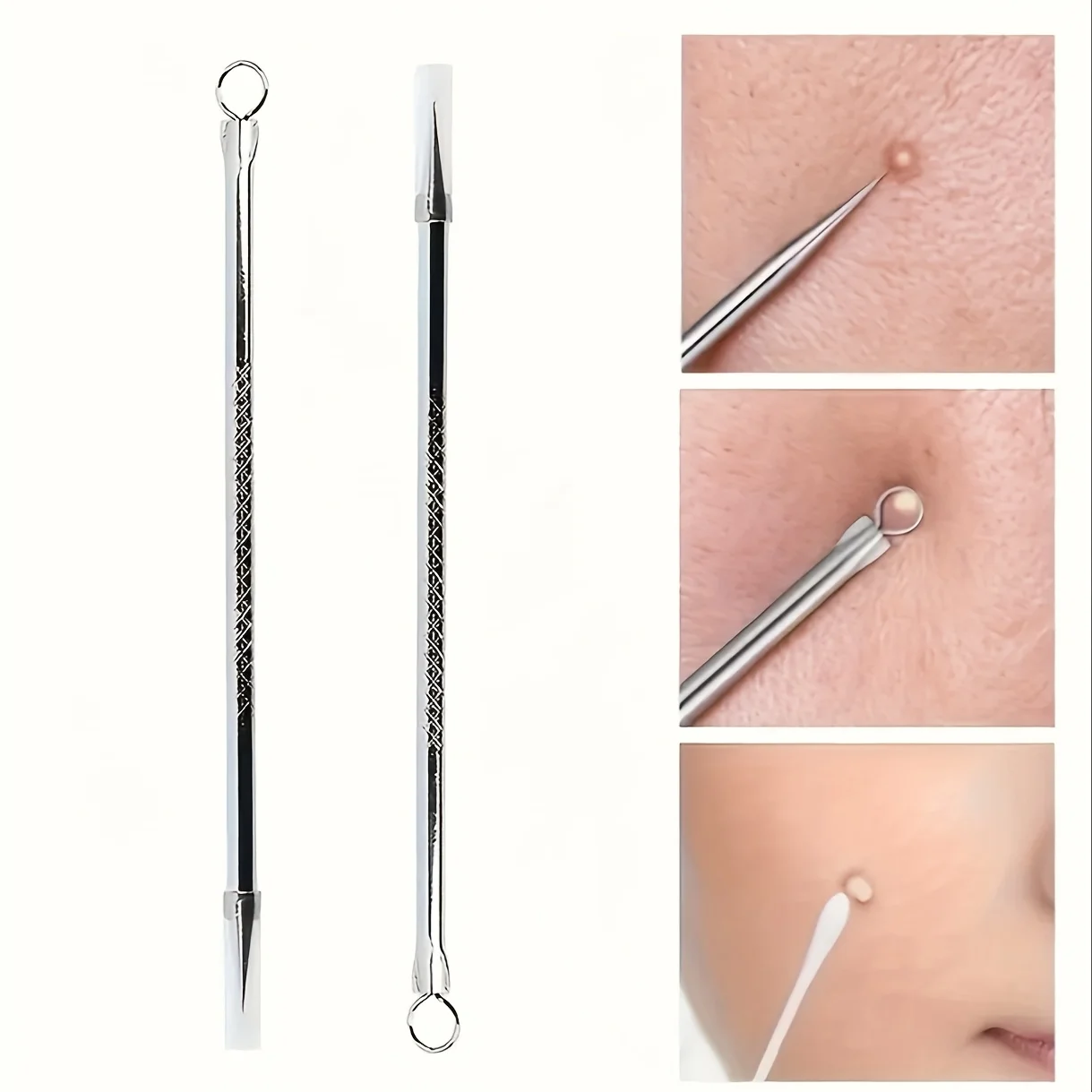 Ensemble de 5 outils d'extraction d'acné, pinces professionnelles pour les pores, pinces à points noirs, outils d'extraction d'acné ultra-fins, outils d'extraction d'acné spécifiques aux salons de beauté, outils d'extraction d'acné pour soins du visage