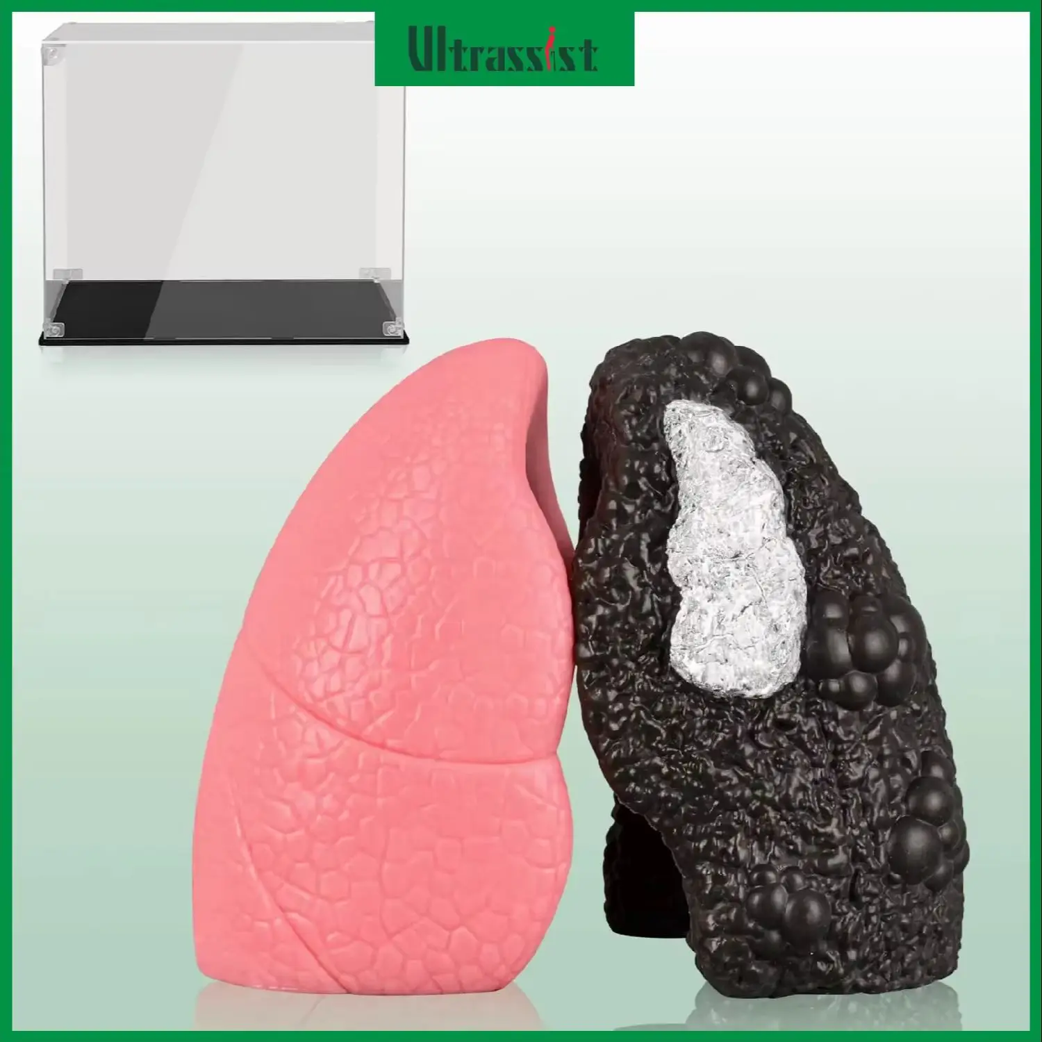 Ultrassist Mini Healthy & Smoker Lung Anatomy Model Silicone Diseased Lung of Smoker for Smoking Education Display Tool