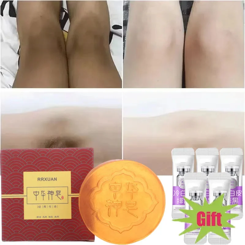 

Body Whitening Soap Deep Clean Skin Chicken Skin Removal Soap Armpit Underarm Knees Bleaching Body Brighten White Care Products