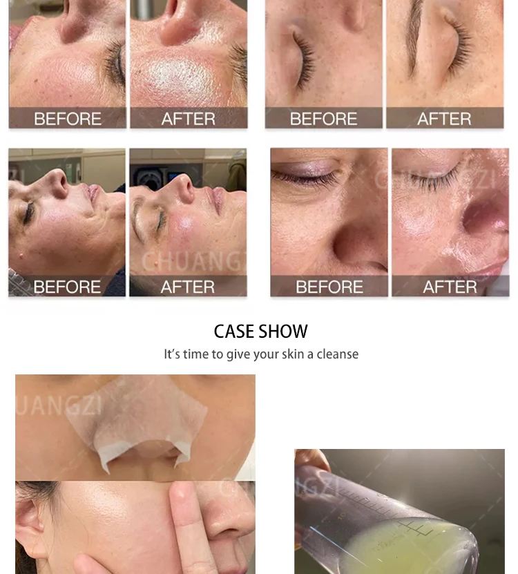 Diamante Jato De Limpeza Profunda, Aqua Faciais Cuidados Com A Pele, cravos removedor, Spa Profissional Máquina Facial, 11 em 1