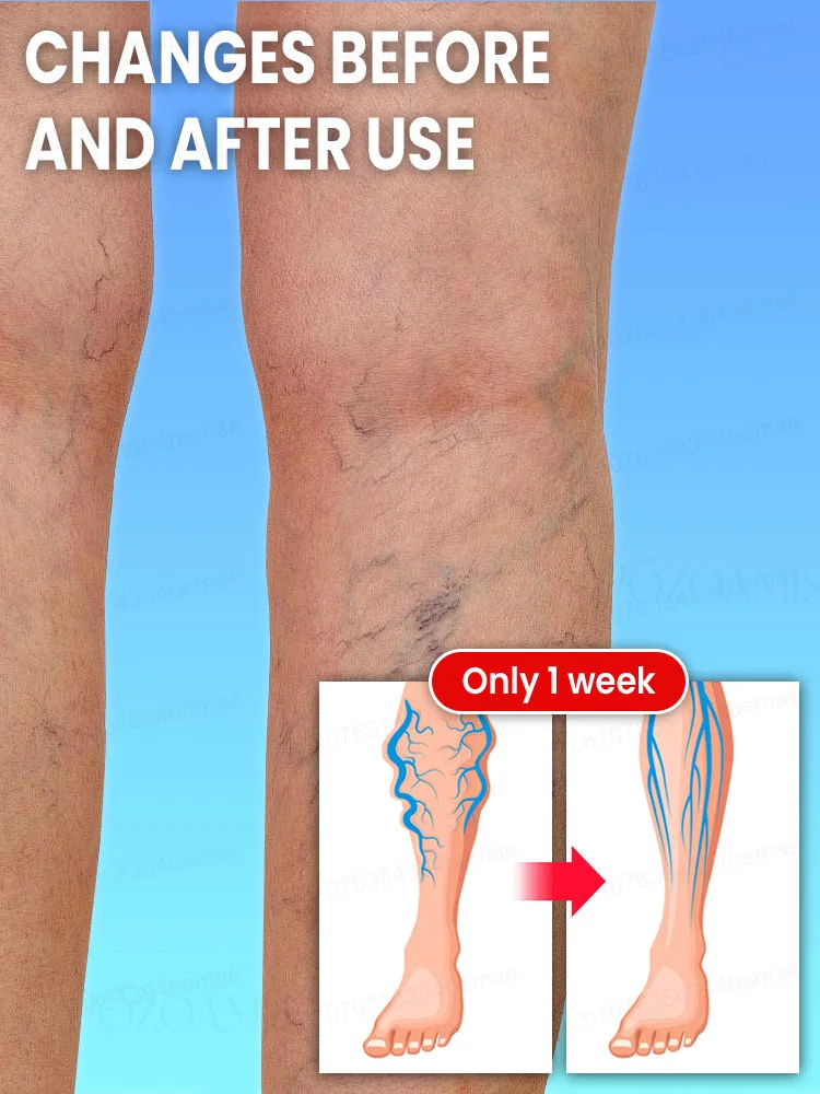 Hᴇᴀʟᴛʜʏ ʟᴇɢs ᴍᴀᴋᴇ ʏᴏᴜ ғᴇᴇʟ ᴄᴏᴍғᴏʀᴛᴀʙʟᴇ ɴᴏ ᴍᴀᴛᴛᴇʀ ʜᴏᴡ ʏᴏᴜ ᴍᴏᴠᴇ