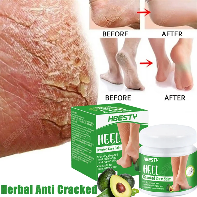 Herbal Anti Cracked Heel Treatment Cream Anti-Drying Removal Callus Dead Skin Balm Hand Foot Mositurizing Repair Skin Care Mask