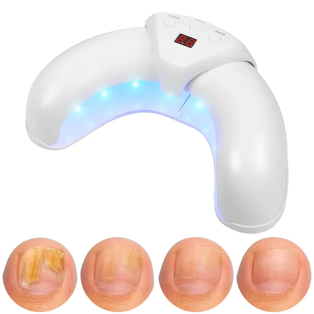

Nail Light Device 470nm Blue Light Nail Cleaning Light Device Nail Treatment Device for Discolored & Thickened Toenails