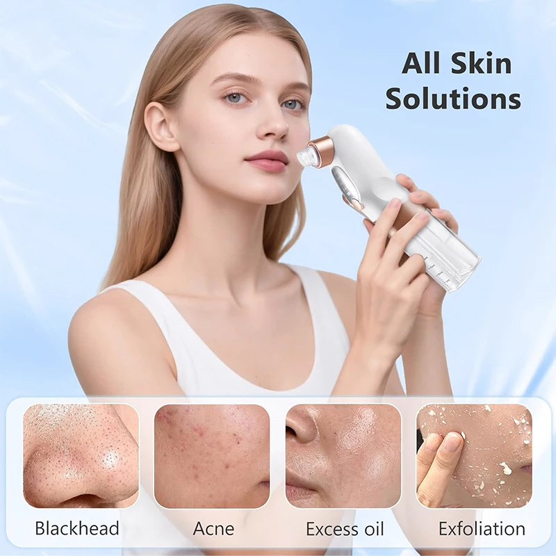 Aspirateur de points noirs, nettoyeur de pores, électrique, boutons, acné, élimination de la tête noire, Cycle d'eau, points noirs, Rechargeable par USB