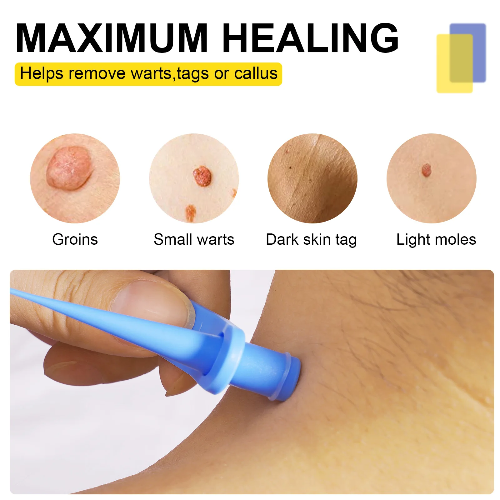 2-IN-1 Wrattenverwijderingsset Vlees Stippen Wratten Acne Vlees Mol Gezicht Pot Snelle verwijderingsset Unisex Body Skin Tag Care Tools