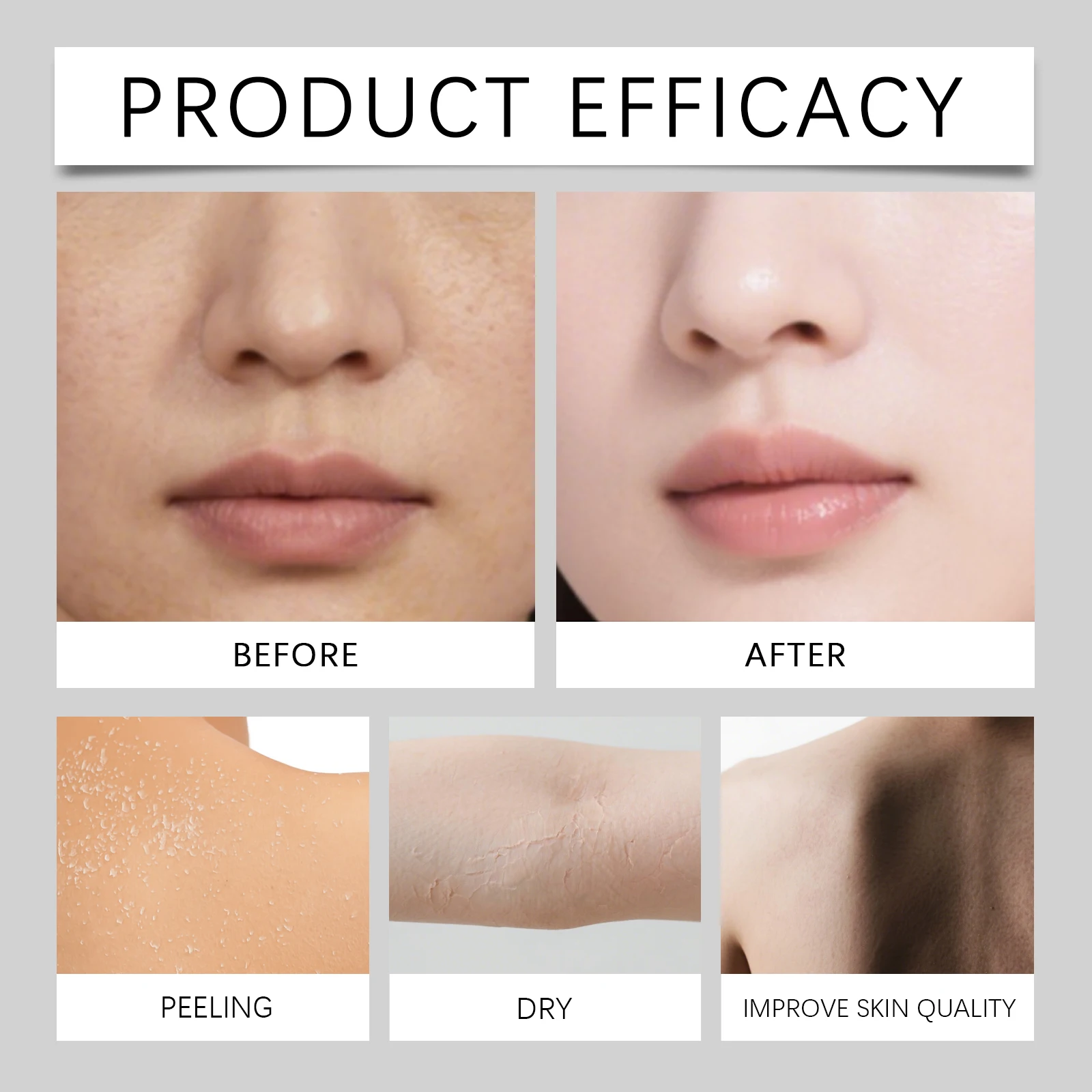 كريم ترطيب عميق للبشرة الجافة مغذي لوشن الجسم القائم على التوالي تخفيف مهدئ للبشرة الخشنة العناية اليومية بالوجه والجسم 4 أونصة