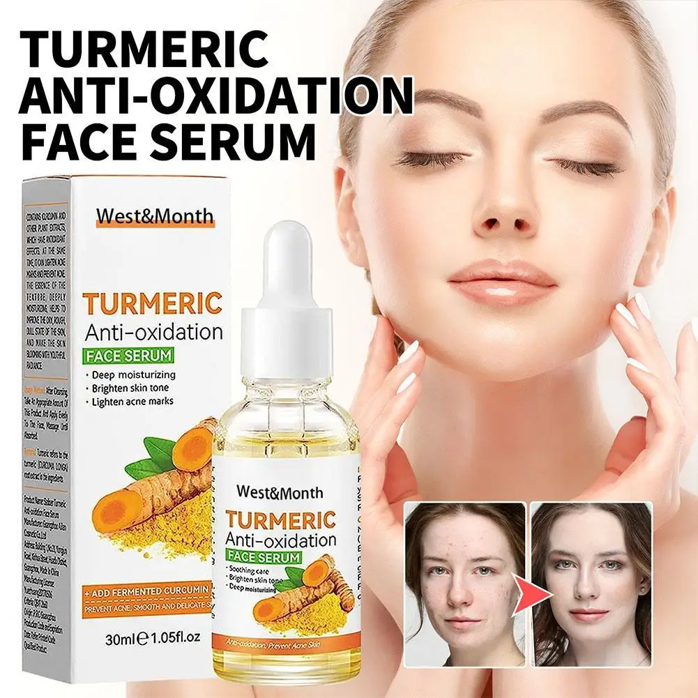 30ML Turmeric Freckle Whitening Serum Anti-oxidant Nourishing Moisturizing Repair Skin Brighten Fade Dark Spot Essence Skin Care