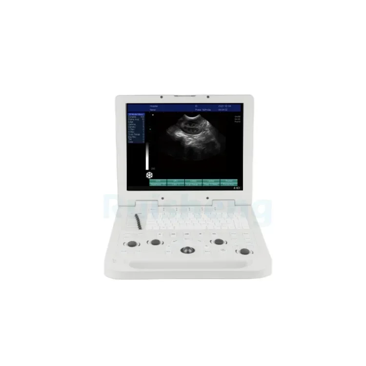 

Ruisheng N20 Full-digital Laptop Ultrasound Scanner Portable B/W Ultrasound Machines for hospital