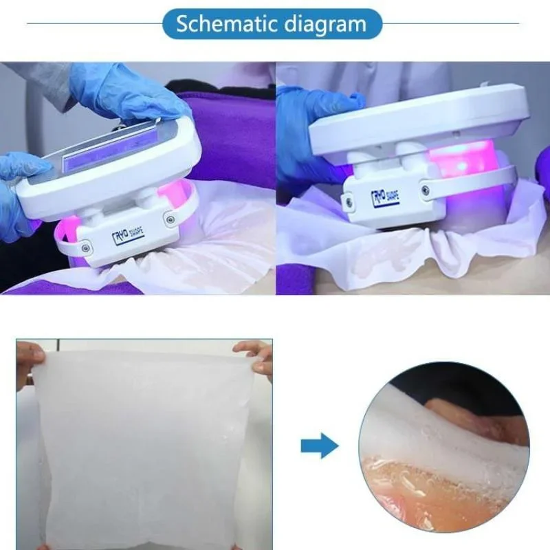 Membrana anticongelante para cavitación Rf, tratamiento de eliminación de celulitis y grasa, máquina de congelación y enfriamiento de Vcuum