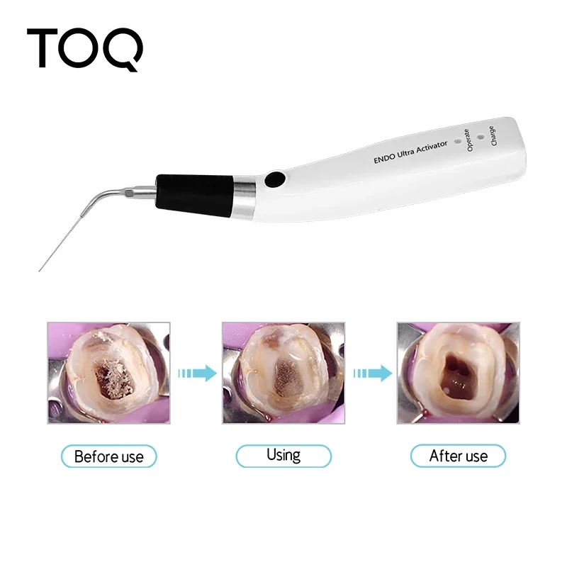 

Dental Endo Ultra Activator Endo Irrigator Cordless Ultrasonic Activator With 6 Tips 40-50Khz 1500mAh For Endodontic Treatment