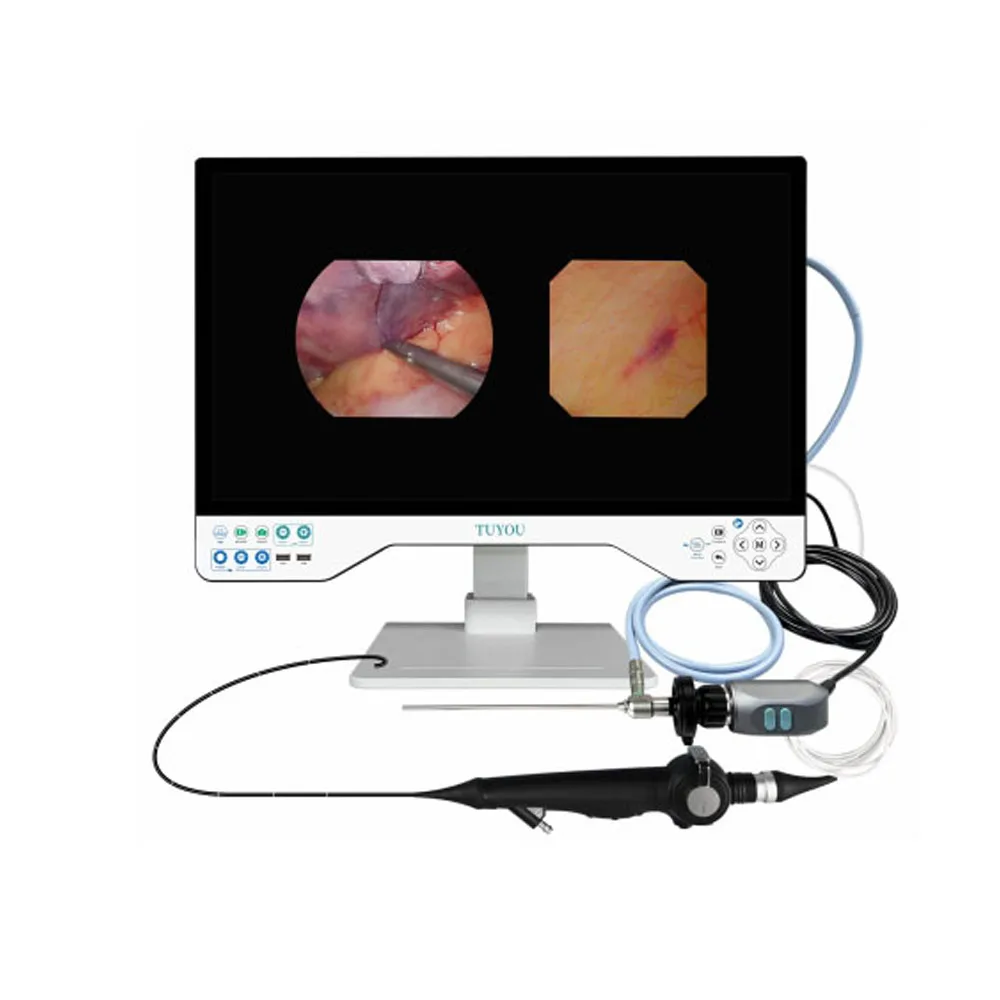 TU-24LSD1E Video Endoscopio ORL Endoscopio HD per otolaringologia Rinoscopio Sinuscope Laringoscopio