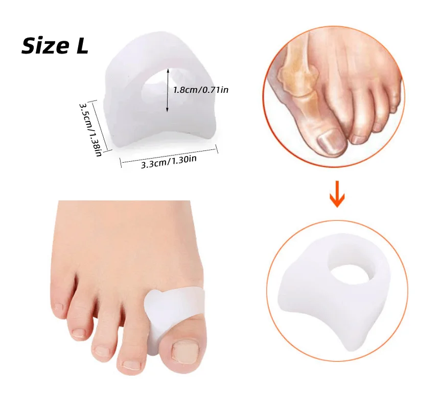 

10Pairs Thumb Toe Separator Bunion Corrector Gel Pad Hallux Valgus Protector Feet Care Orthopedic Finger Spacers Pain Relif