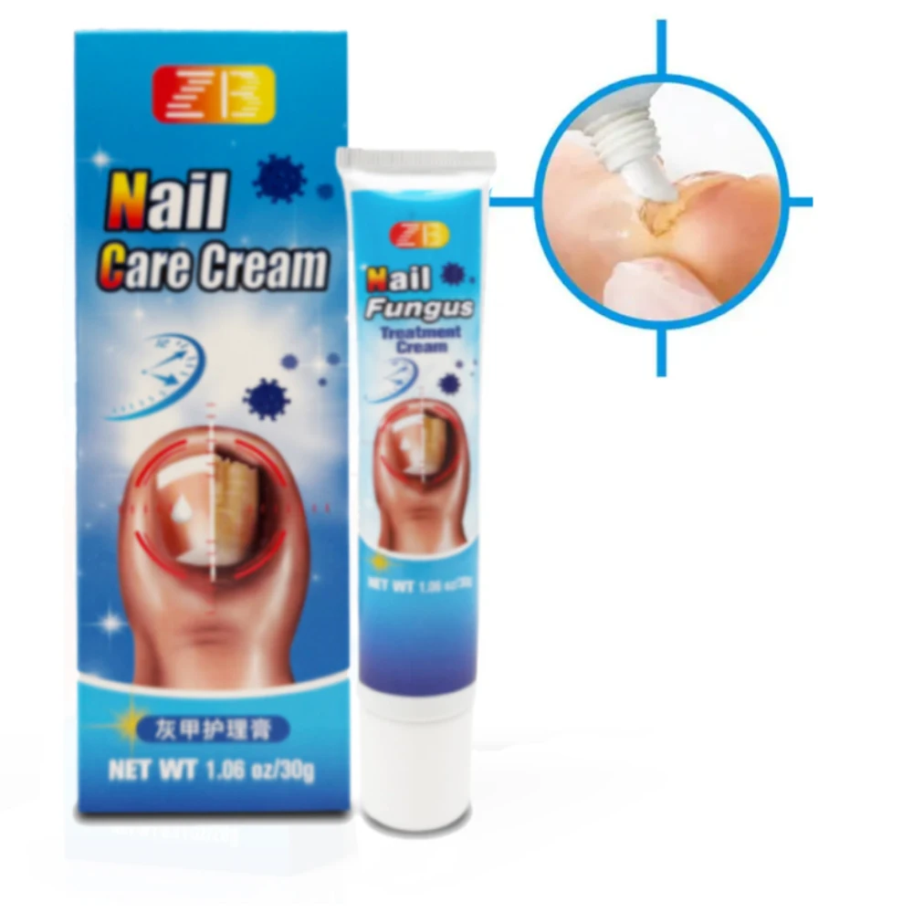 30g Nail Fungus Ointment Fungal Infection Nails Cream Feet Anti Removal Onychomycosis Paronychia Toe Repair Essence Herbal Cream - view 3