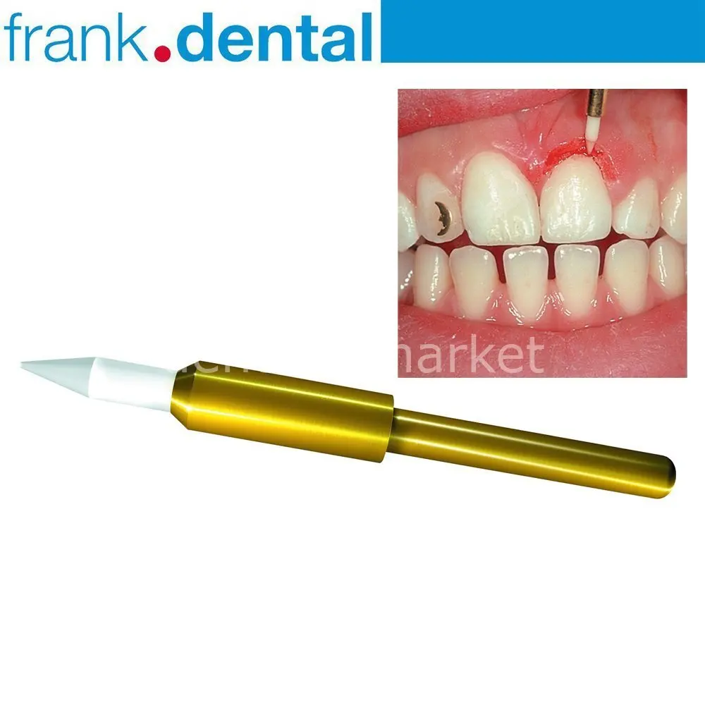 Frank Dental - Soft Tissue Gingiva Trimmer Burs - Ceramic Soft Tissue Trimming Bur - GT48L