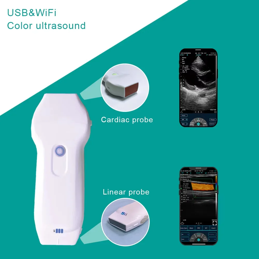 Dual Frequency Ultrasound Probe, Wireless WIFI Type, 96 Elements 32 Channel, Supports iOS Android Windows Multi-platform