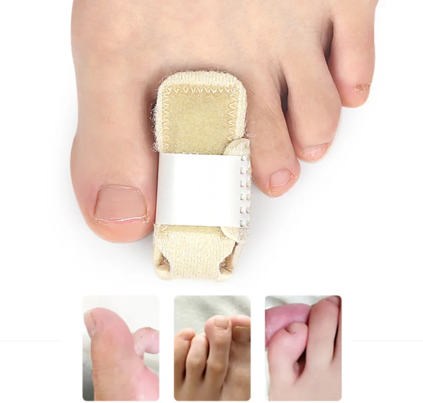 3Pcs Pedicure Splint Toe Finger Straightener for Bent Claw Crooked Corrector Alignment Protector Foot Care Correction Pain Relif