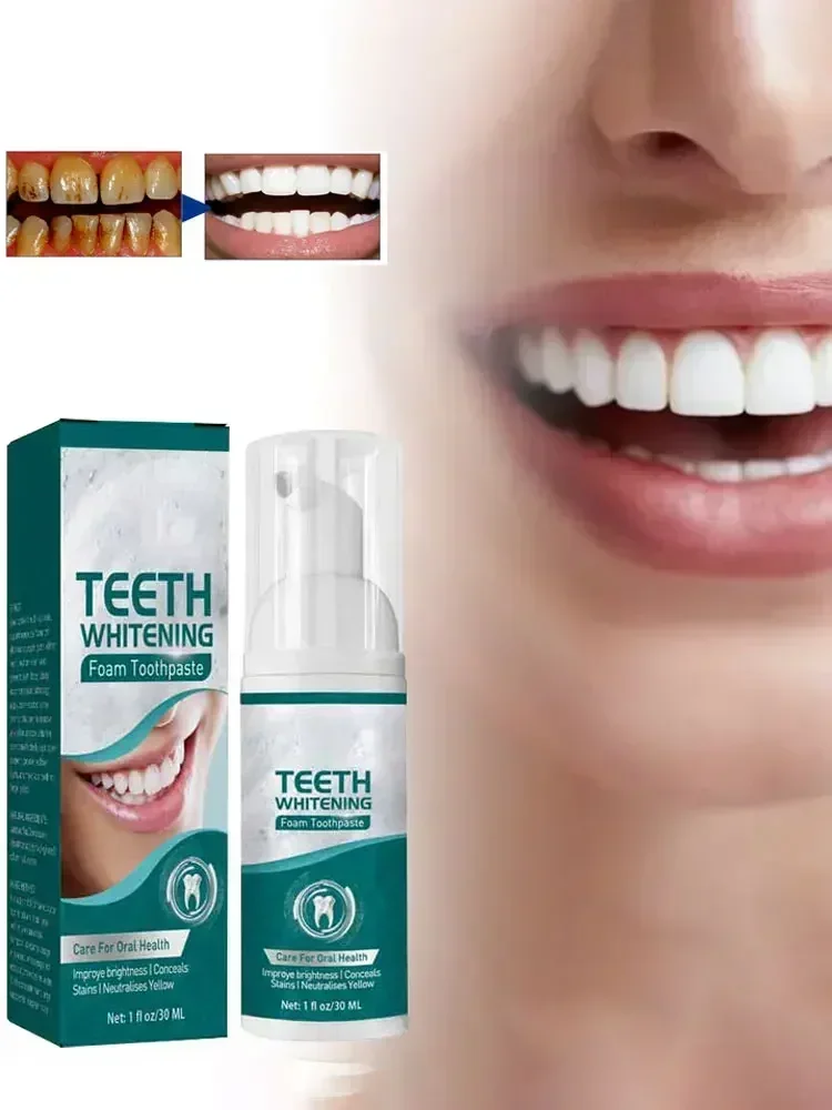 Dental Calculus Remover Toothpaste Whitening Teeth Mouth Odour Removal Bad Breath Preventing Periodontitis Dental Cleaning