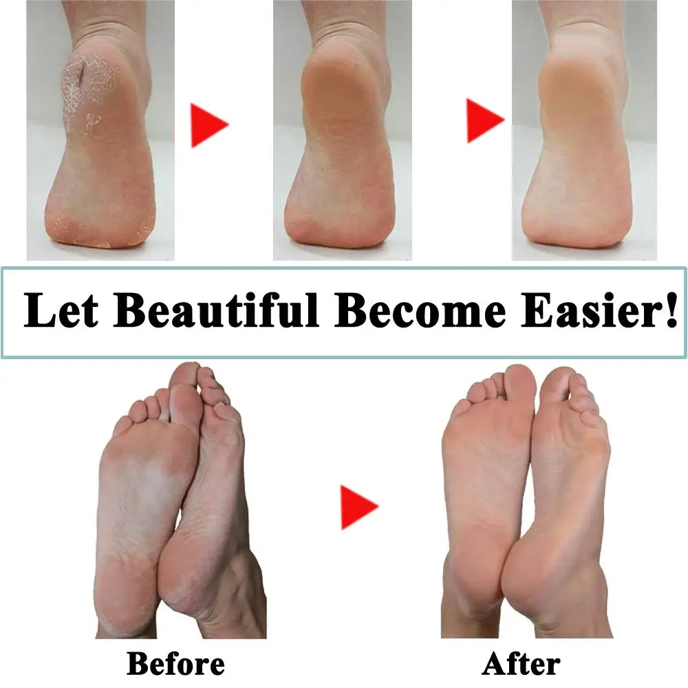 Testine per strumenti per la cura dei piedi Ricariche per la rimozione della pelle dura Pedi Rulli di ricambio per strumento per la cura dei piedi Scholls File